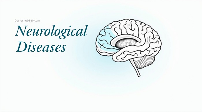 Doctorhub360.com Neurological Diseases
